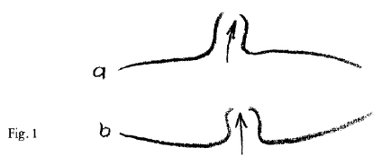 AltName